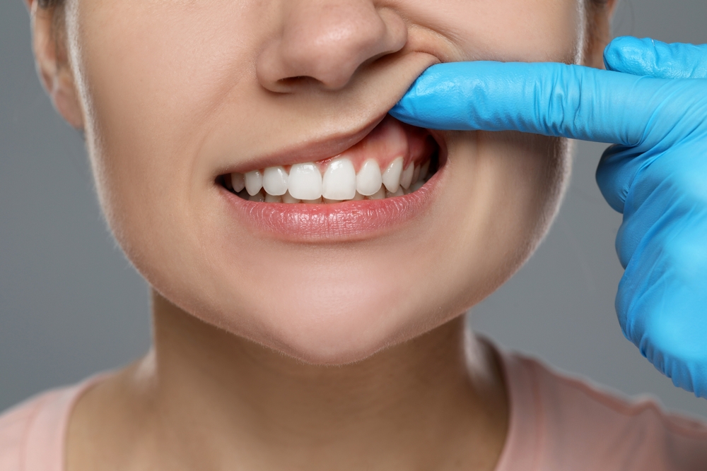 Periodontal Care / Therapy