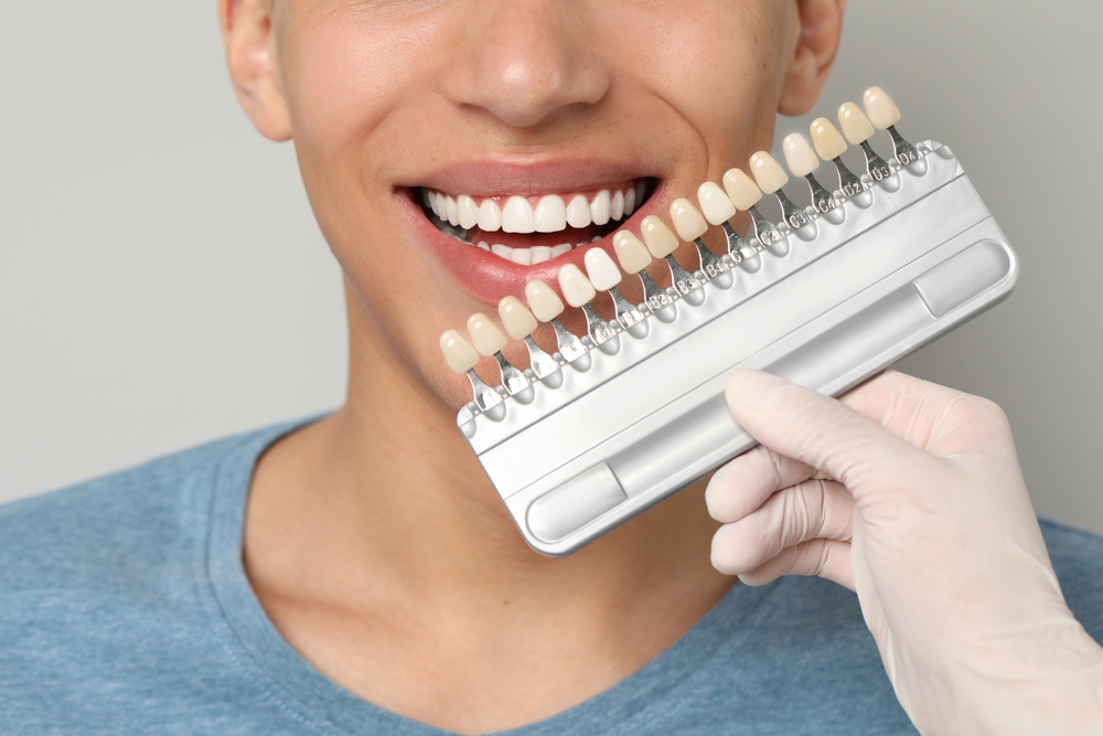 Porcelain Veneers