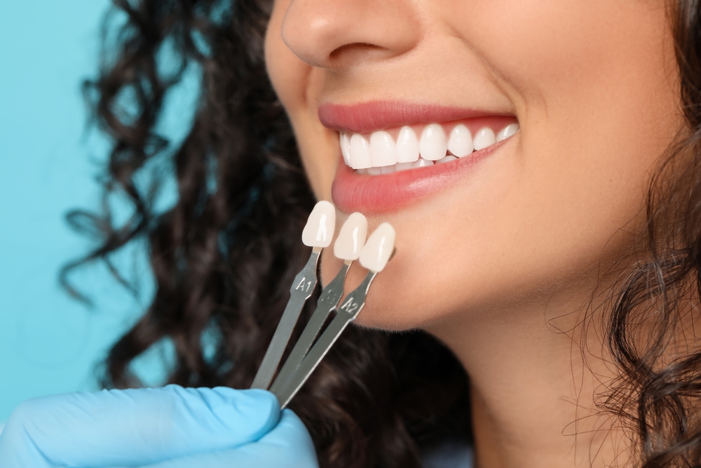 Professional teeth whitening consultation