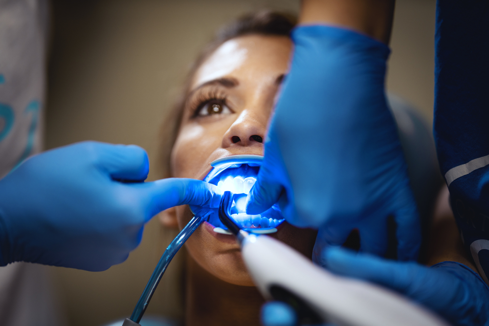 Dental Bonding
